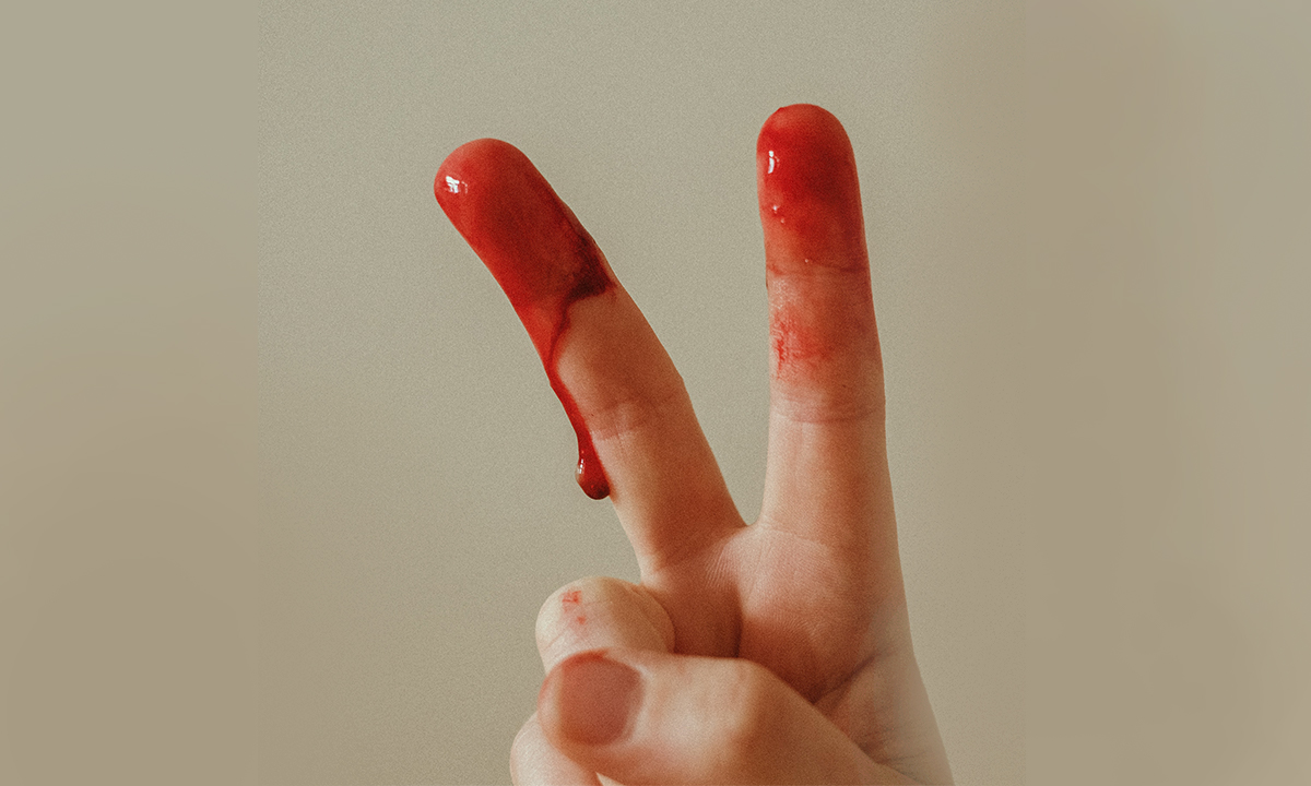 Let’s Change The Vicious Cycle Of Period Poverty – A Human Rights Crisis